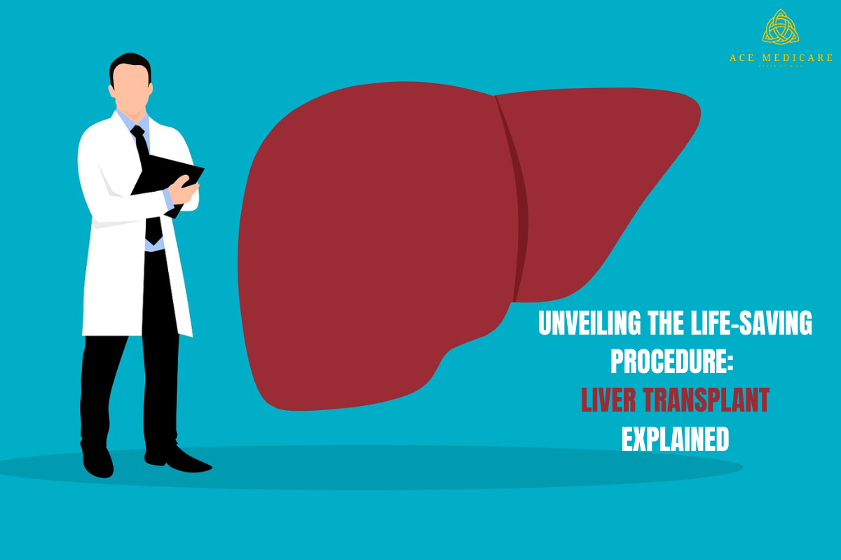Unveiling the Life-Saving Procedure: Liver Transplant Explained